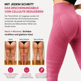 Ttonicofficial 3D Legging – Verabschieden Sie sich auf natürliche Weise von Lipödem-Schmerzen, Schwellungen und Cellulite