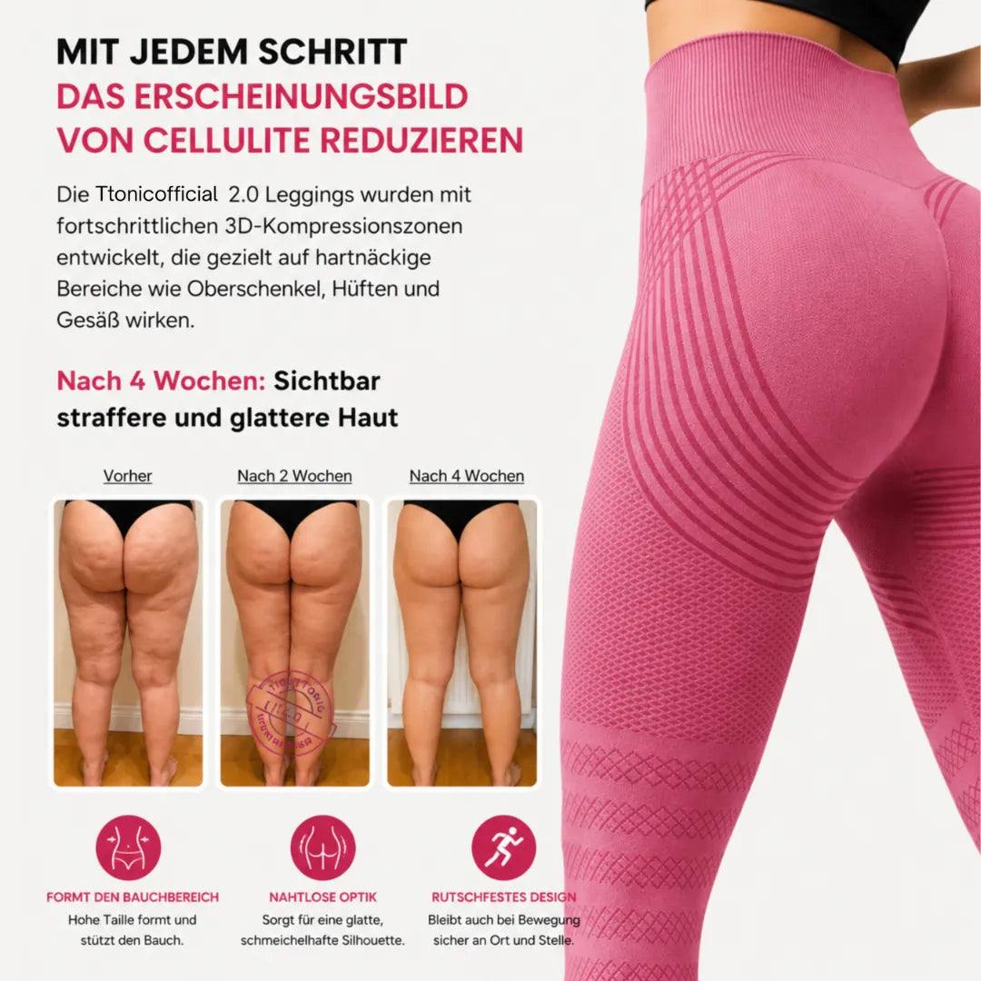 Ttonicofficial 3D Legging – Verabschieden Sie sich auf natürliche Weise von Lipödem-Schmerzen, Schwellungen und Cellulite