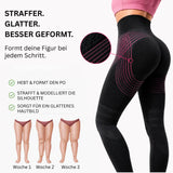 Ttonicofficial 3D Legging – Verabschieden Sie sich auf natürliche Weise von Lipödem-Schmerzen, Schwellungen und Cellulite