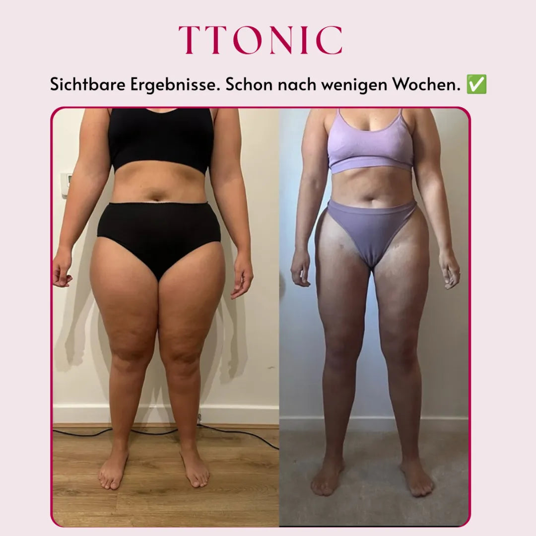 Ttonicofficial 3D Legging – Gegen Lipödem, Schwellungen & Cellulite