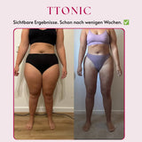 Ttonicofficial 3D Legging – Gegen Lipödem, Schwellungen & Cellulite